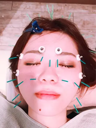 むくみたるみ専門☆ 美容鍼・小顔矯正のエステ・リラクイメージ