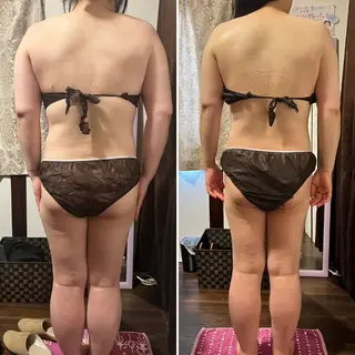 シミ取り*韓国肌 エステサロン✶クロヌのエステ・リラクイメージ