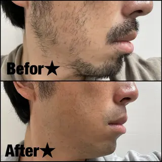 メンズ BLACK VELVET 24所属・BLACKVELV ET(YUME)の眉毛・アイブロウイメージ