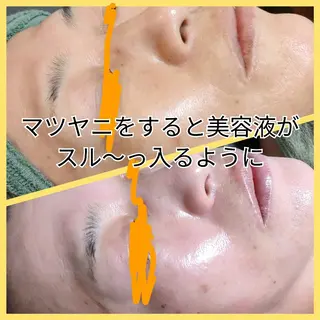 女性専用 フェイシャルサロン新小岩　シエスタ所属・女性専用フェイシャル シエスタのエステ・リラクイメージ