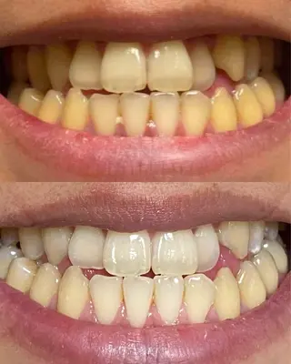 メンズ リヴァセル 調布店のエステ・リラクイメージ