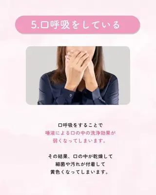 セルフホワイトニング エクシア大曽根店のその他イメージ