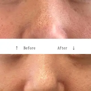 Lavieriche "ラヴィリッシュ"のエステ・リラクイメージ