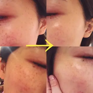 エステデ ビューティー朝倉のエステ・リラクイメージ