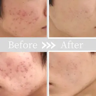 小顔・ツルツル素肌 ハリステリアのエステ・リラクイメージ