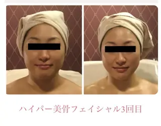 DEA  LUCE所属・痩身&小顔エステ DEA   LUCEのエステ・リラクイメージ