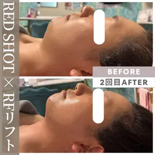 小顔矯正専門店 【RED】池田のエステ・リラクイメージ