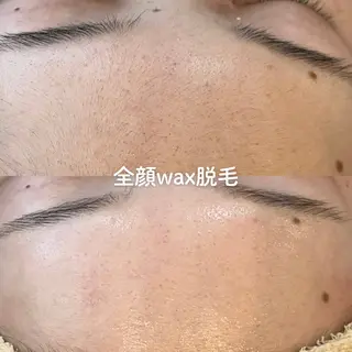 EST BEAUTY所属・顔ワックス脱毛/ ハーブピーリングのエステ・リラクイメージ