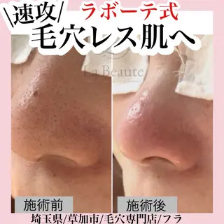 毛穴専門店hula 杉山智美のエステ・リラクイメージ