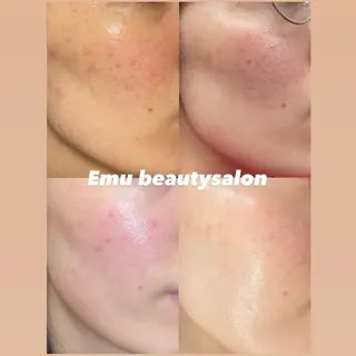 Emu beautysalon所属・Emu beauty salonのエステ・リラクイメージ