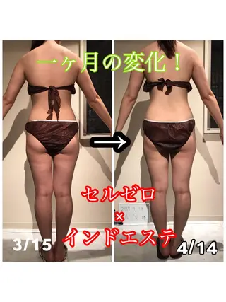 Cielo(シエロ) ダイエット専門店のエステ・リラクイメージ