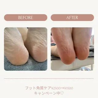 ネイル Aurum ♡︎ miyukiのネイルデザイン