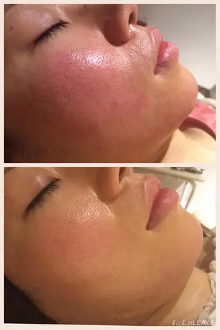 アニメ,Vオタク× 即効痩せエステサロンのエステ・リラクイメージ