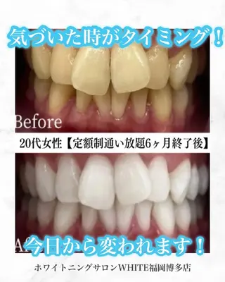 キッズ メンズ セルフホワイトニング WHITE福岡博多店のエステ・リラクイメージ