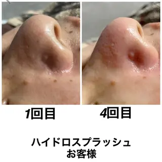 ネイル・エステサロンUILANI所属・ネイル・エステサロン UILANIのネイルデザイン