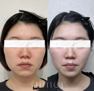 aimer 栄店のエステ・リラクイメージ