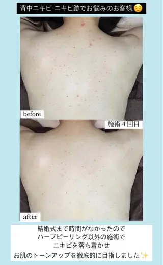 ベラージュ【美背中・ 美尻・フェイシャル】のエステ・リラクイメージ