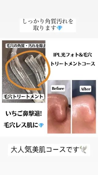 セミロング カラー パーマ ヘアアレンジ メンズ キッズ ネイル マツエク・マツパ アイブロウ Chloe-クロエ- 脱毛/フェイシャルのエステ・リラクイメージ