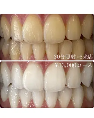 メンズ ホワイトニングルーム　川崎店所属・ホワイトニング ルーム　川崎店のその他イメージ