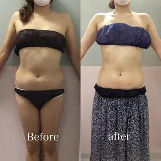 nico sideのエステ・リラクイメージ