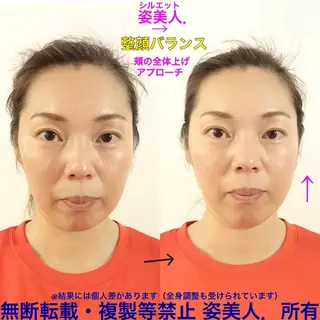 筋膜整体＆小顔矯正 　姿美人.シルエットのエステ・リラクイメージ