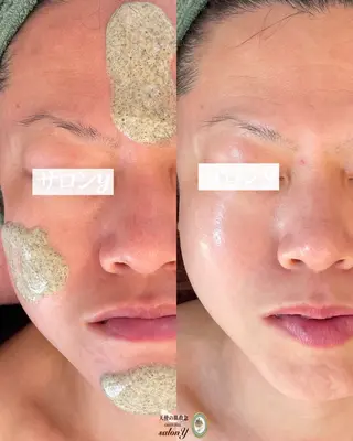 グリーンピール専門店 サロンY【大阪】のエステ・リラクイメージ