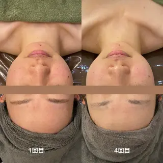 DUPE&MORE所属・DUPE&MORE 店長kanaeのエステ・リラクイメージ