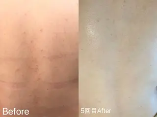 アイラッシュ&エステサロンLinda西宮所属・小顔&毛穴・肌質改善 LINDA西宮 AIのエステ・リラクイメージ