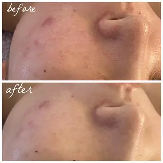 メンズ メナード岐阜市茜部 杉浦のエステ・リラクイメージ