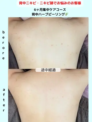 ベラージュ【美背中・ 美尻・フェイシャル】のエステ・リラクイメージ