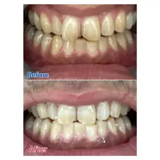 M渋谷店所属・M渋谷 ホワイトニングのエステ・リラクイメージ