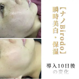 痩身•小顔•ツヤ肌 810神戸元町店のエステ・リラクイメージ