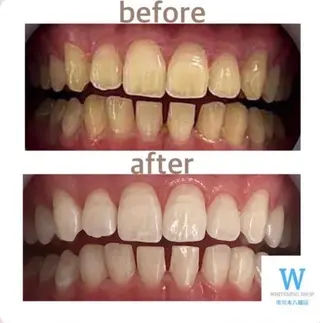 ホワイトニング ショップ本八幡店のエステ・リラクイメージ