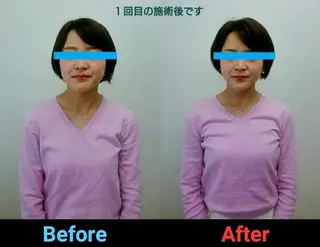 小顔矯正 頭痛専門のブライト整体 所属・ブライト整体 〜1人整体.完全予約のエステ・リラクイメージ