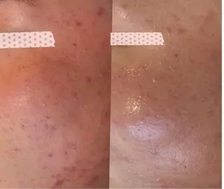 mimiBrun 肌質改善サロンのエステ・リラクイメージ