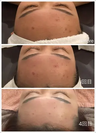 OPREA 栄店のエステ・リラクイメージ