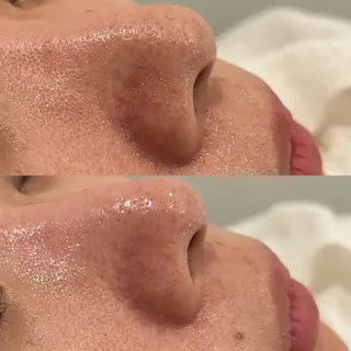 デアイム東広島所属・中井 小春のエステ・リラクイメージ