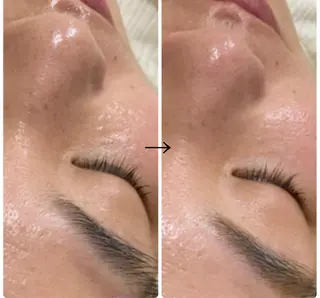 aroma  YURARI所属・韓国艶美人// 毛穴ケア🌹のエステ・リラクイメージ