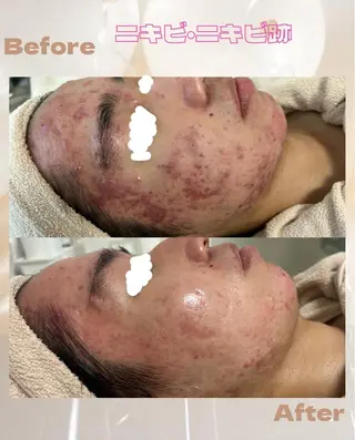 都度払い肌改善専門店 店長二上文香のエステ・リラクイメージ