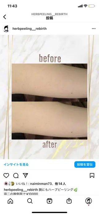 ハーブピーリング特選 認定rebirthのエステ・リラクイメージ