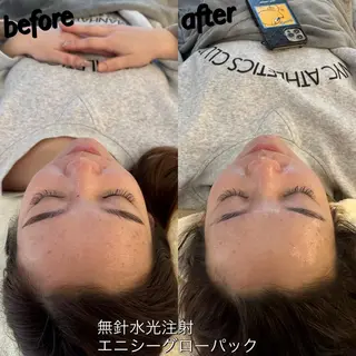 うなじ脱毛/美肌脱毛 LABELのエステ・リラクイメージ