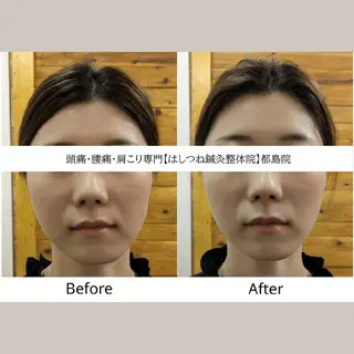 頭痛・腰痛・肩こり 特化してます。 橋岡のエステ・リラクイメージ