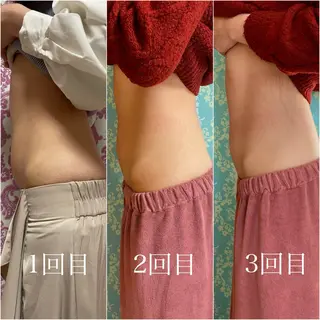 小顔矯正専門店 【RED】池田のエステ・リラクイメージ