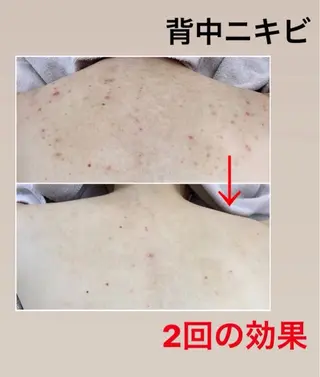 お肌と歯のサロン　Sona Mior所属・藤井 ののみのエステ・リラクイメージ