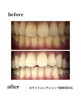 ホワイトニングショップ静岡葵区店所属・ホワイトニング ショップ葵区静岡駅店のその他イメージ