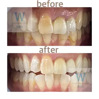 ホワイトニング ショップ船橋２号店のエステ・リラクイメージ