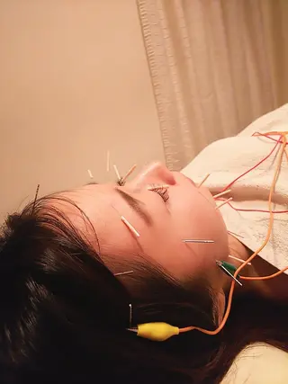 むくみたるみ専門☆ 美容鍼・小顔矯正のエステ・リラクイメージ