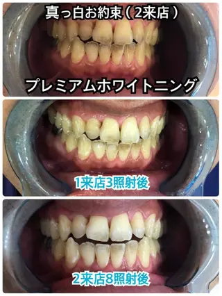 Platinum Beauty 四条烏丸店所属・吉田亮利 ホワイトニング専門店のその他イメージ