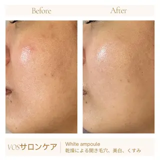 1ヶ月後も半分残る 高持続LEDエクステのマツエク・マツパデザイン