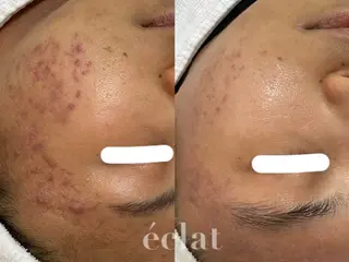 private salon éclat所属・ニキビ・毛穴専門 éclat/エクラのエステ・リラクイメージ